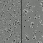 Normale Tumorzellen (links) und mit KHS101 behandelte abgestorbene Tumorzellen (rechts).